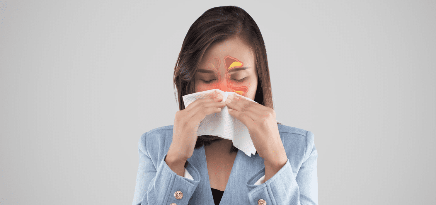 Острый синусит